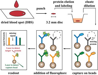 Newborn Screening for Presymptomatic Diagnosis of Complement and Phagocyte Deficiencies